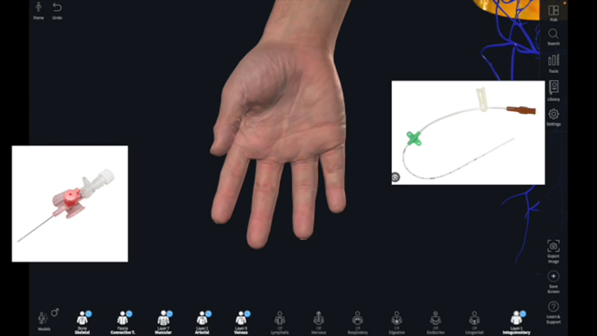 Dummy video preview image for video: Venous Drainage of Upper Limb Overview
